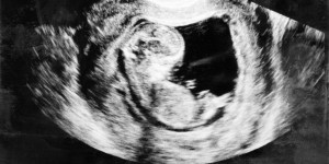 Florida legislature bans most abortions after 15 weeks of pregnancy